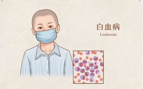 甲醛是否真的會導致兒童患白血病？